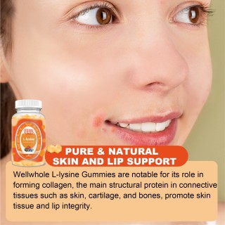 L-Lysine 500mg Supplement  Gummies for for Kids and Adults